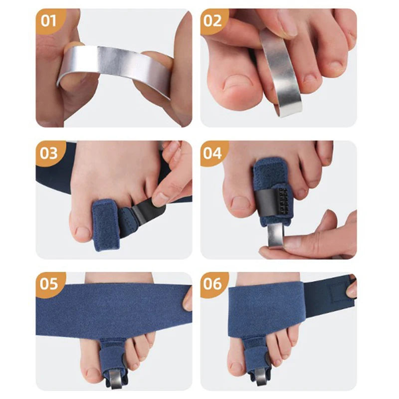 1Pcs Toe Corrector Toe Fracture Fixator Orthotics Foot Bone Thumb Adjuster Correction Soft Pedicure Socks Bunion Straightener