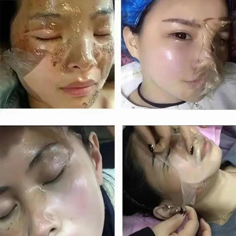 Peel Off Instant Freckle Removal Mask Effective Treatment Chloasma Pigmentation Acne Scars Dark Spots Facial Skin Care Products