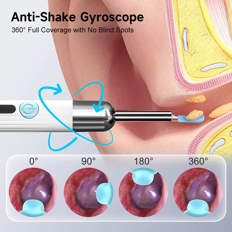 Visual WiFi Otoscope Camera 4.2mm 1080P HD Ear Picker for IOS/Android Ear Cleaning Wireless Endoscope with Ear Wax Removal Tools