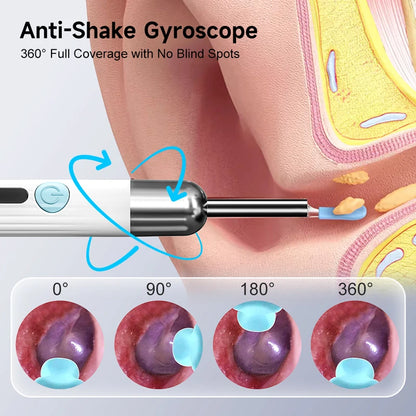 Visual WiFi Otoscope Camera 4.2mm 1080P HD Ear Picker for IOS/Android Ear Cleaning Wireless Endoscope with Ear Wax Removal Tools