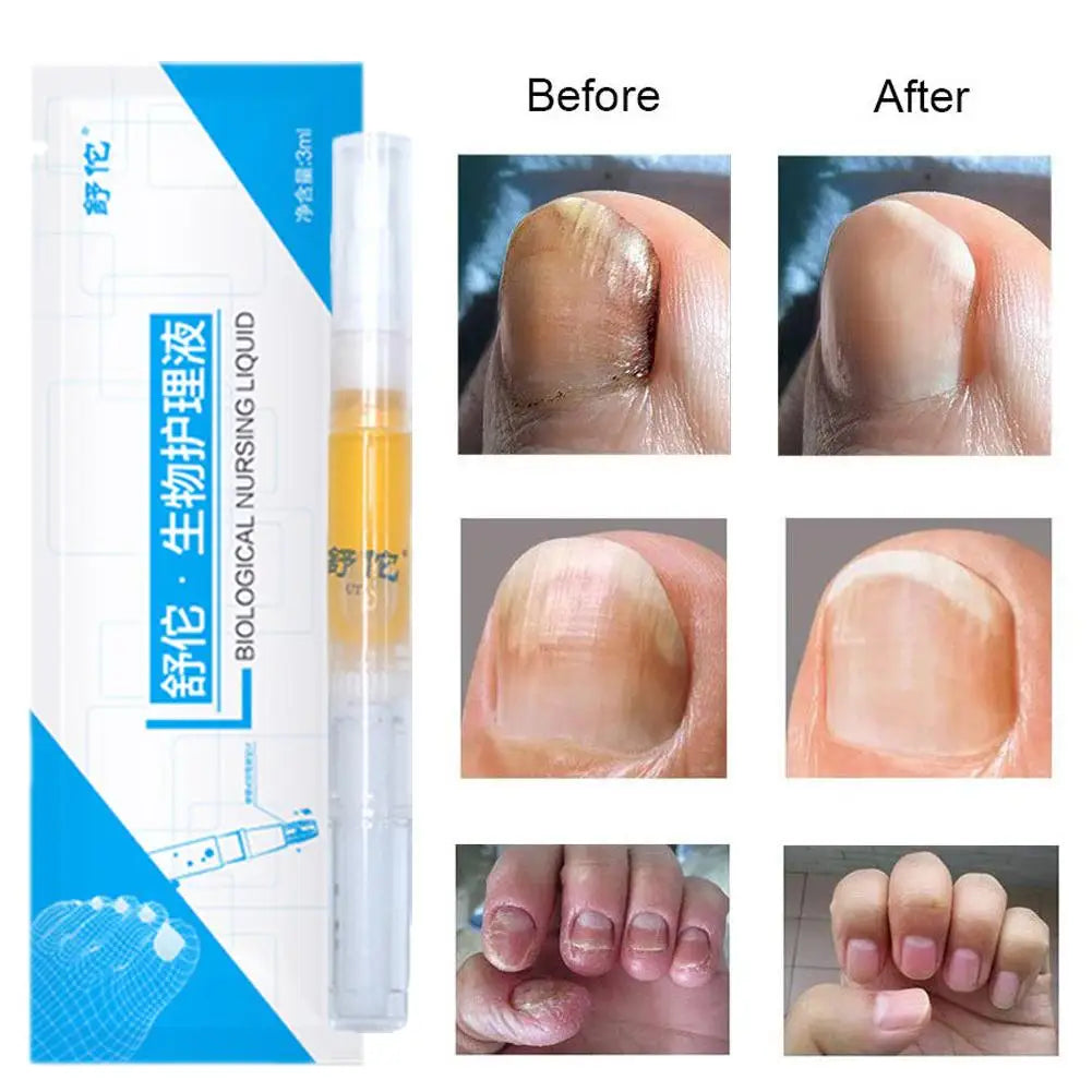 High-end Nail Care Pen Toenail Repair Pen With Natural Ingredients Nail Beauty Health Nail Repair Essence Gentle Care Tool