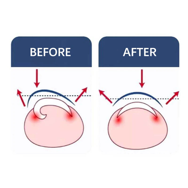 Toenail Correction Foot Care Tool Ingrown Toenail Corrector Tools Pedicure Recover Embed Toe Nail Treatment Professional