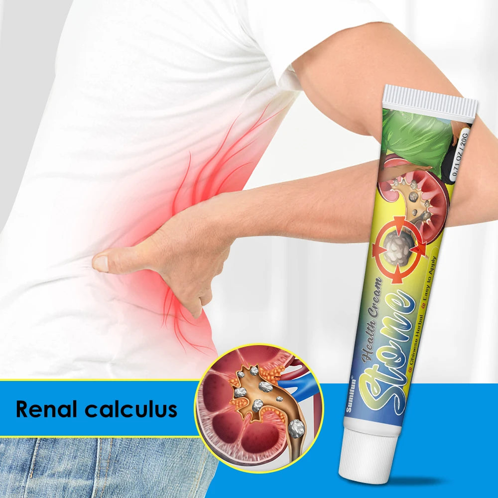 Sumifun 20g Renal Kidney Gallstone Treatment Cream Waist Abdominal Pain Urination Interruption Lithiasis Ointment Health Care