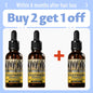 2026 Latest Technology New Products Anti-Hair Loss Essence Promotes Hair Growth and Improves the Scalp Environment