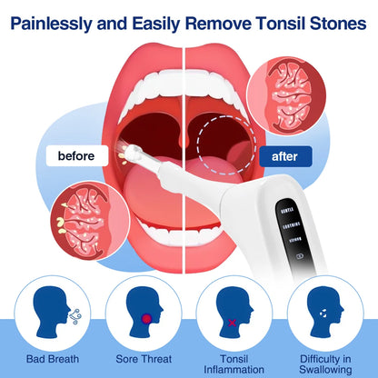 Electric Tonsil Stone Remover 3 Suction Eliminate Bad Breath Home Oral Hygiene Tonsil Stone Extractor Swallow Difficulty Relief