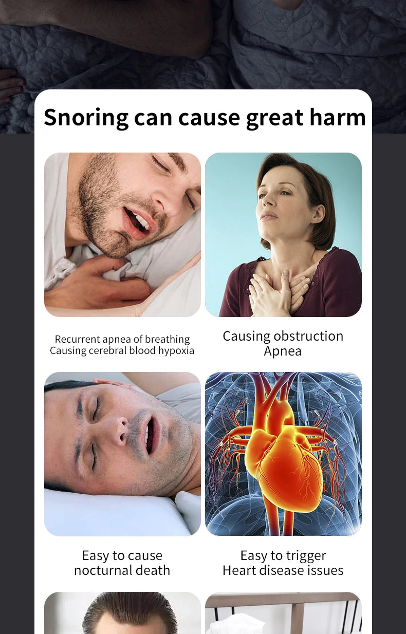 Smart Anti-Snoring Devices Magnetic Anti Snore EMS Easy Breathe Improve Sleeping Aid Apnea Guard Night Device Dropshipping