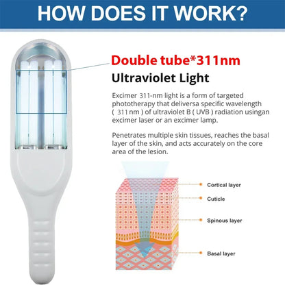 311nm Ultraviolet Phototherapy Instrument Double Lamp UVB Lamp for Vitiligo Treatment Psoriasis Lamp Skin Disease Device