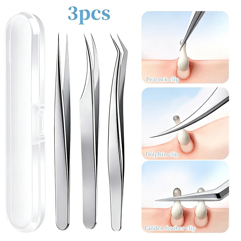 3pcs Professional Blackhead Tweezers - Ultra-Thin Tip, Stainless Steel Tweezers for Whiteheads, Ingrown Hairs And Facial Removal