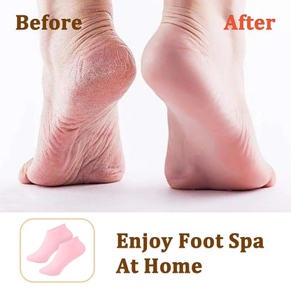 2 Pairs Of Moisturizing Silicone Foot Socks - Specially Designed For Cracked Feet, Contains Massage And Moisturizing Gel