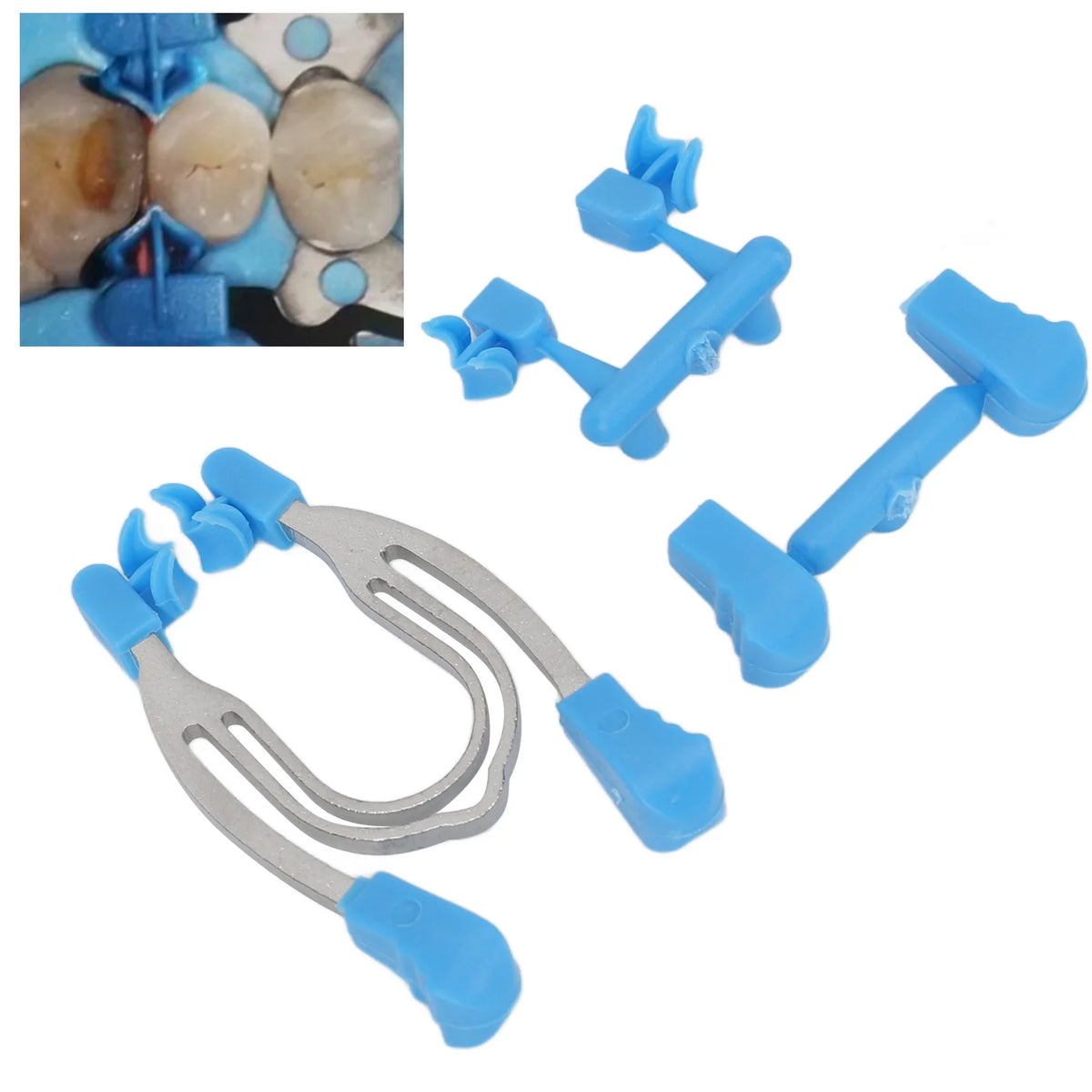 Dental Sectional Contoured Matrices Clip Set High Temperature Resistant  Clamp for Hospital Teeth Dental Matrices Clamp