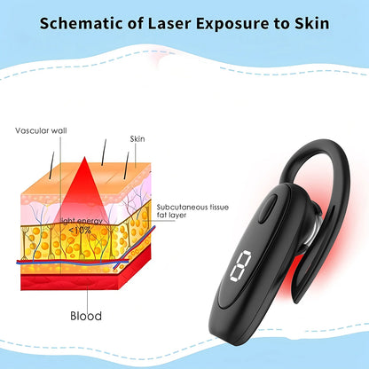 Smart nanometer 650nm Tinnitus Ear Laser Therapy Irradiation Tinitus Otitis Media Deafness Treatment Ear-hanging Style Earplug