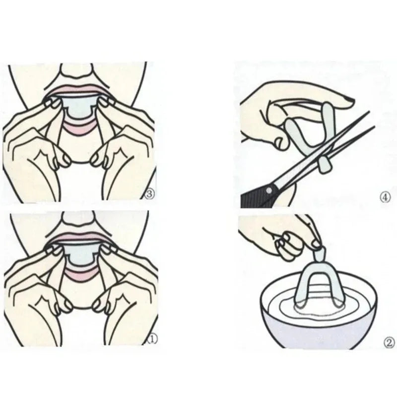1-6Pairs Anti Snoring Bruxism Sleeping Mouth Guard Tray Stop Teeth Grinding Sleep Aid Night Guard Gum Shield Mouth Health Care