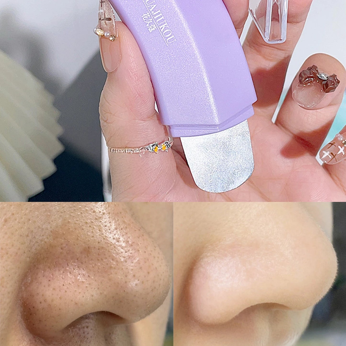 Double Headed Deep Cleansing Blackhead And Whitehead Removal Tool For Nose And Face - Skin Pore Cleaner Skin Care Beauty Tools