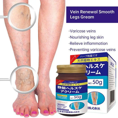 Natural Ingredients Vein Relief Cream for Legs Soothes Aching Varicose Veins Alleviates Swelling - Home Use for Leg Vein Health