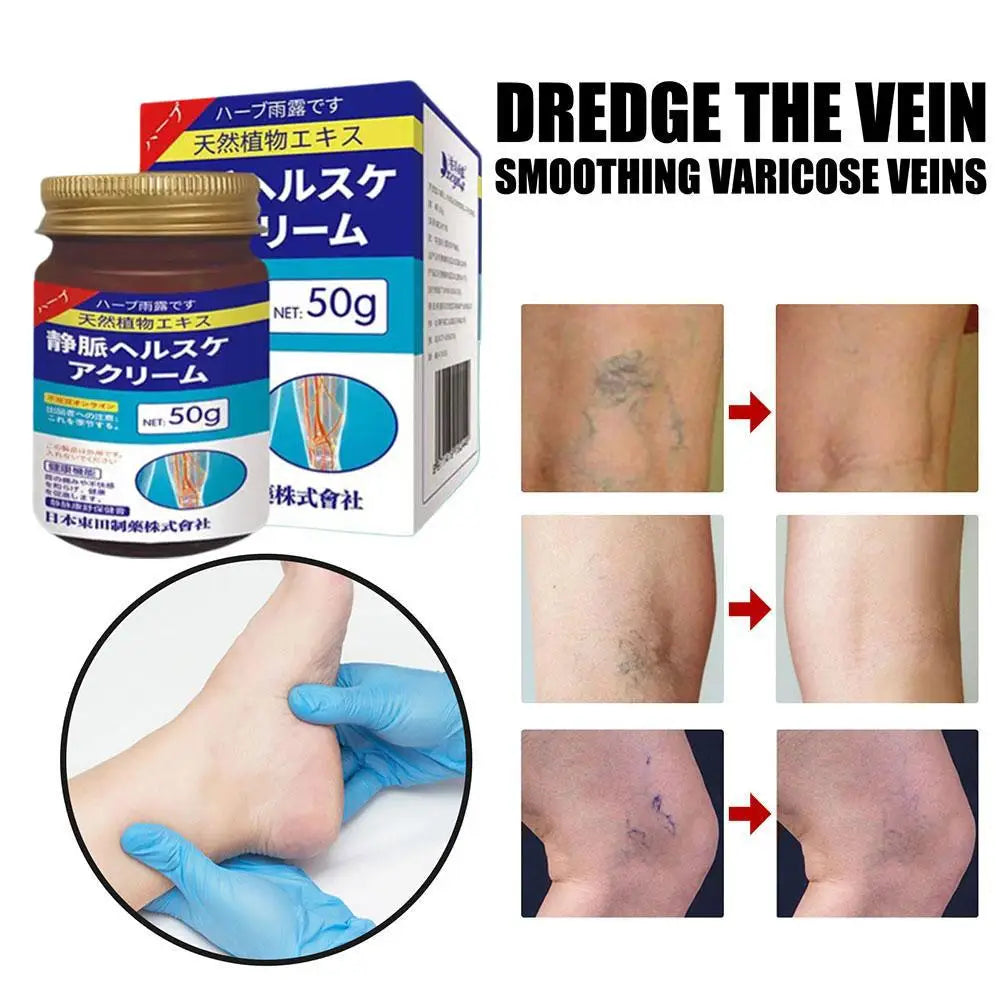 Natural Ingredients Vein Relief Cream for Legs Soothes Aching Varicose Veins Alleviates Swelling - Home Use for Leg Vein Health