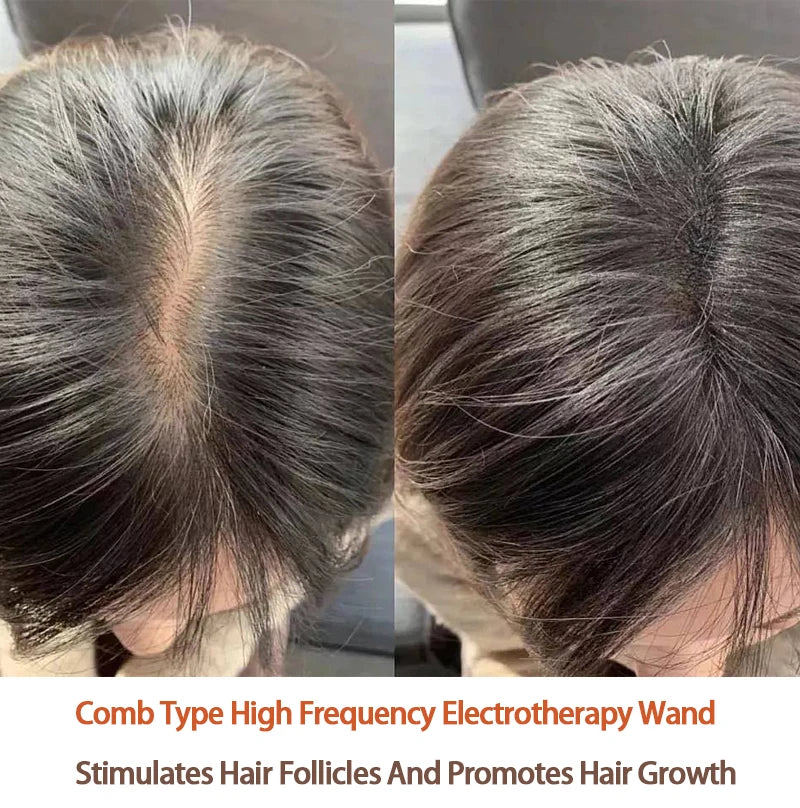 Replace HF Wand Spiral Electrode Glass Tube Argon Violet Ray Neon Acne Skin Care Face Body Massage