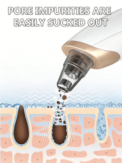 Electric Blackhead Remover Vacuum Cleaner Black Dots Vacuum Cleaner Skin Pimple Acne Extractor Facial Cleaning Electric