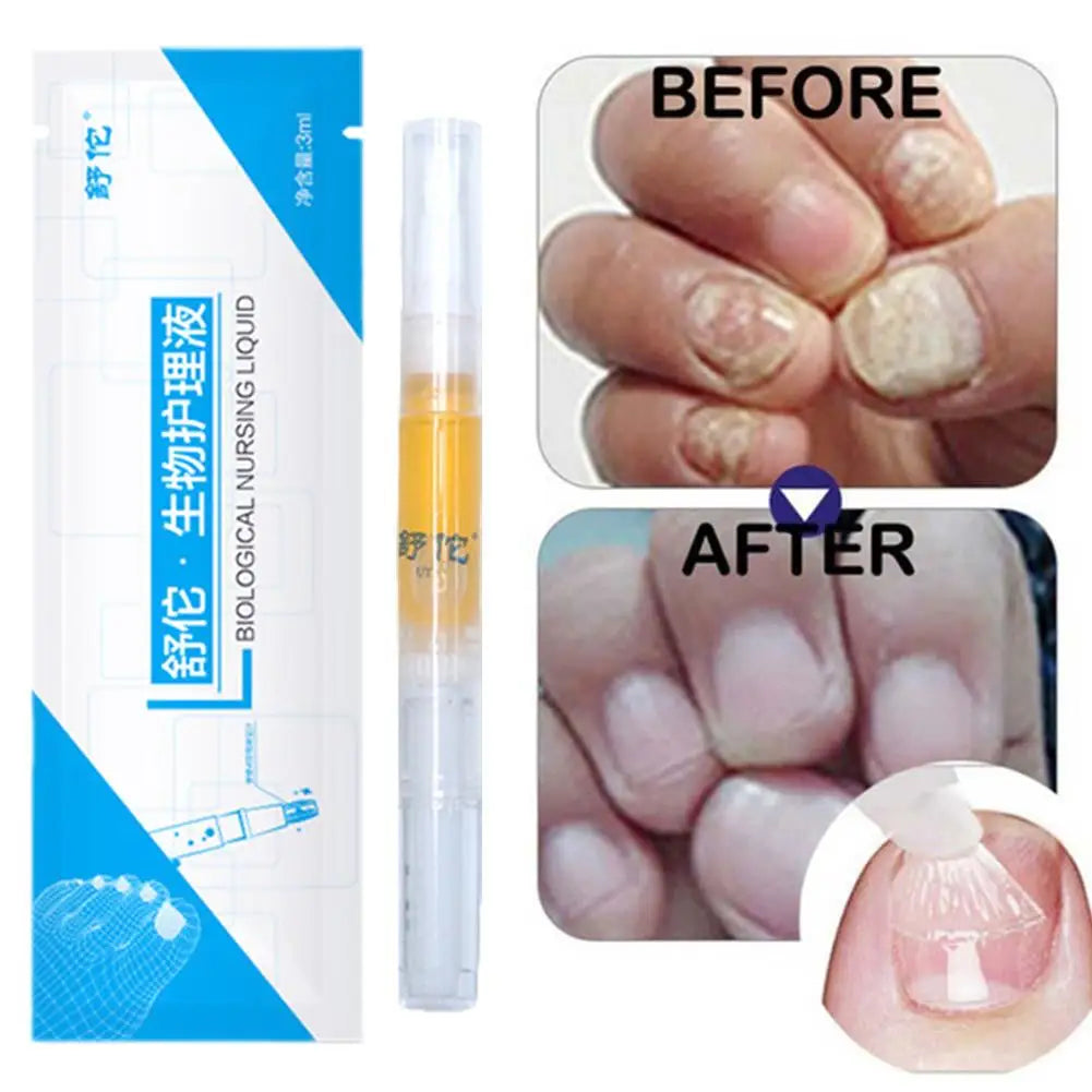 High-end Nail Care Pen Toenail Repair Pen With Natural Ingredients Nail Beauty Health Nail Repair Essence Gentle Care Tool