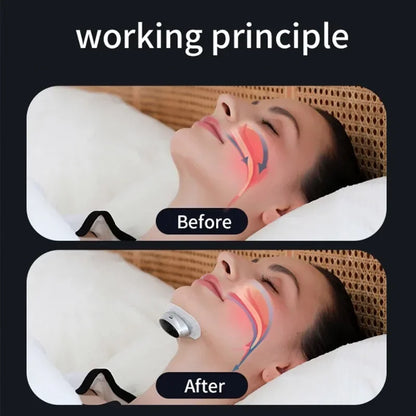 Anti-Snoring Devices Intelligent Throat Massger Ultralight Magnetic Anti Snore EMS Apnea Guard Night Snore Stopper Sleeping Care