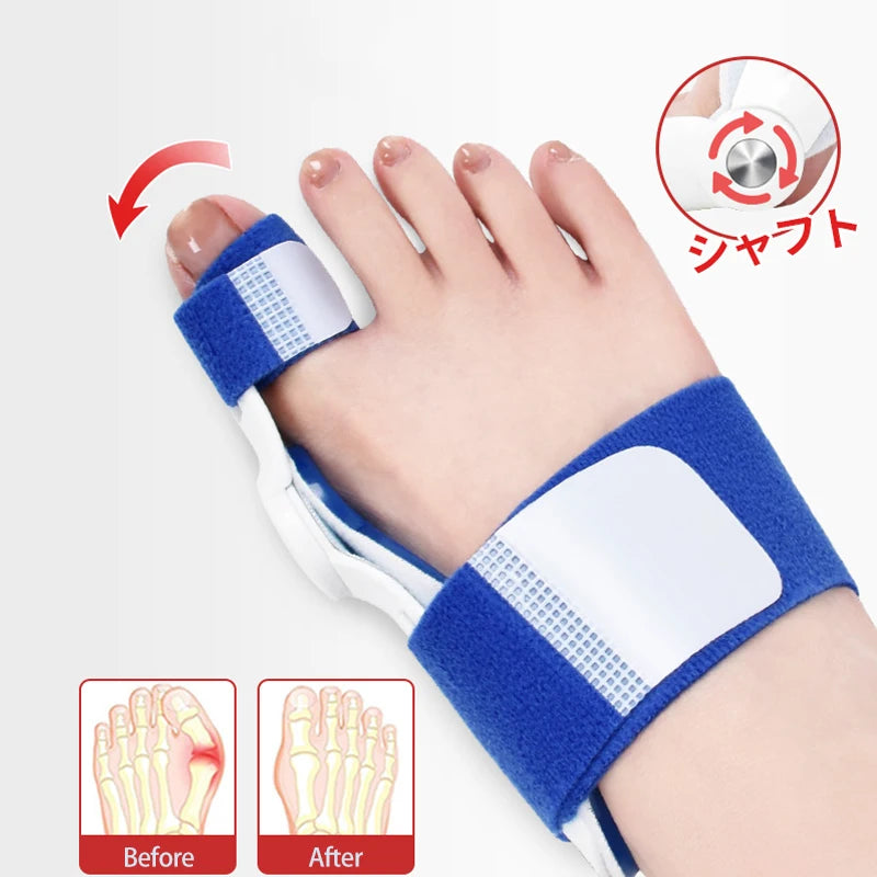 Bunion Splint Big Toe Straightener Corrector Foot Pain Relief Hallux Valgus Correction Orthopedic Supplies Pedicure Foot Care