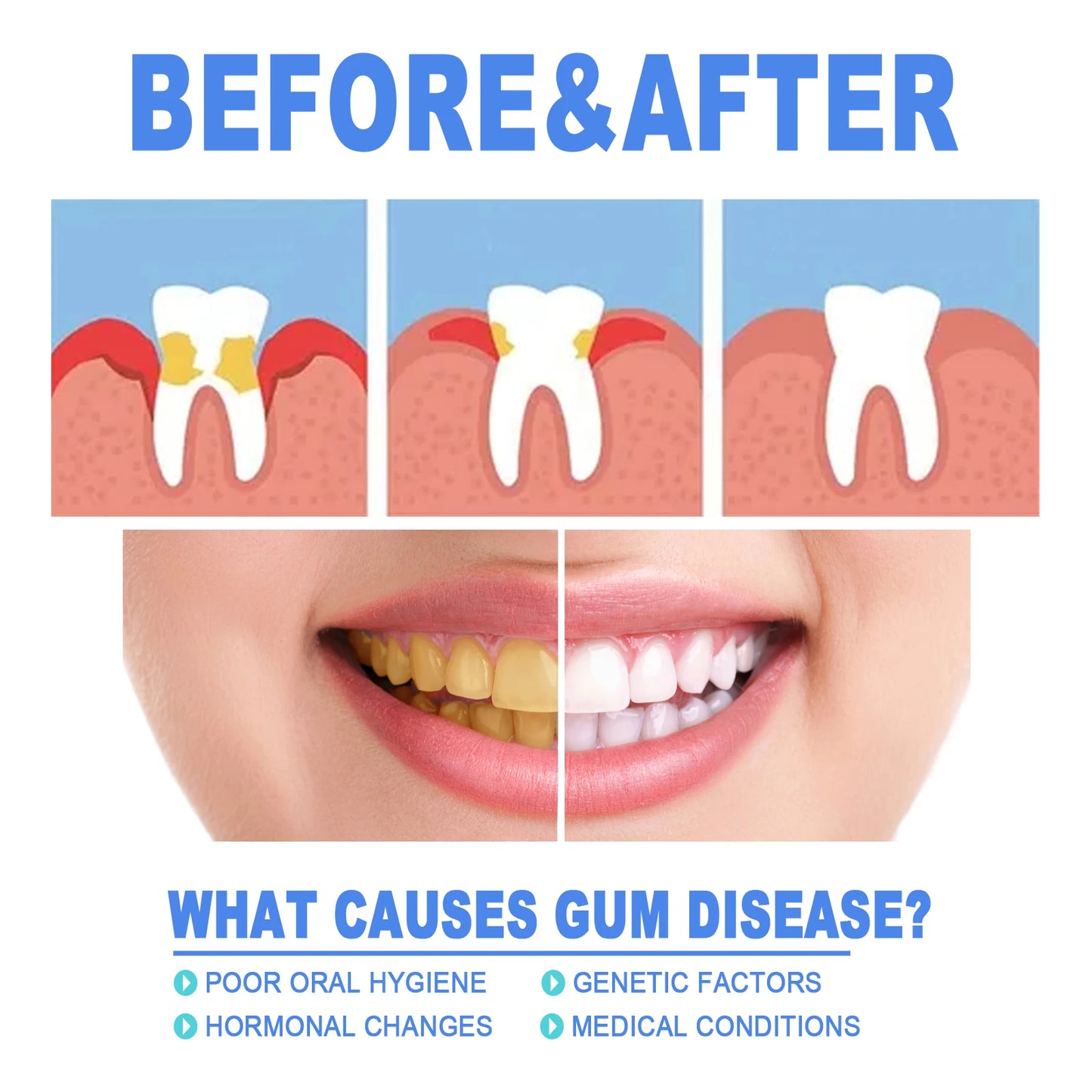 Damaged Gum Repair Care Gel Deep Cleaning Effectively Removes Yellow Teeth Stains Tartar Fresh Breath Teeth Cleaning Gel 4ml