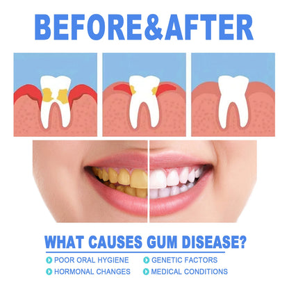 Damaged Gum Repair Care Gel Deep Cleaning Effectively Removes Yellow Teeth Stains Tartar Fresh Breath Teeth Cleaning Gel 4ml