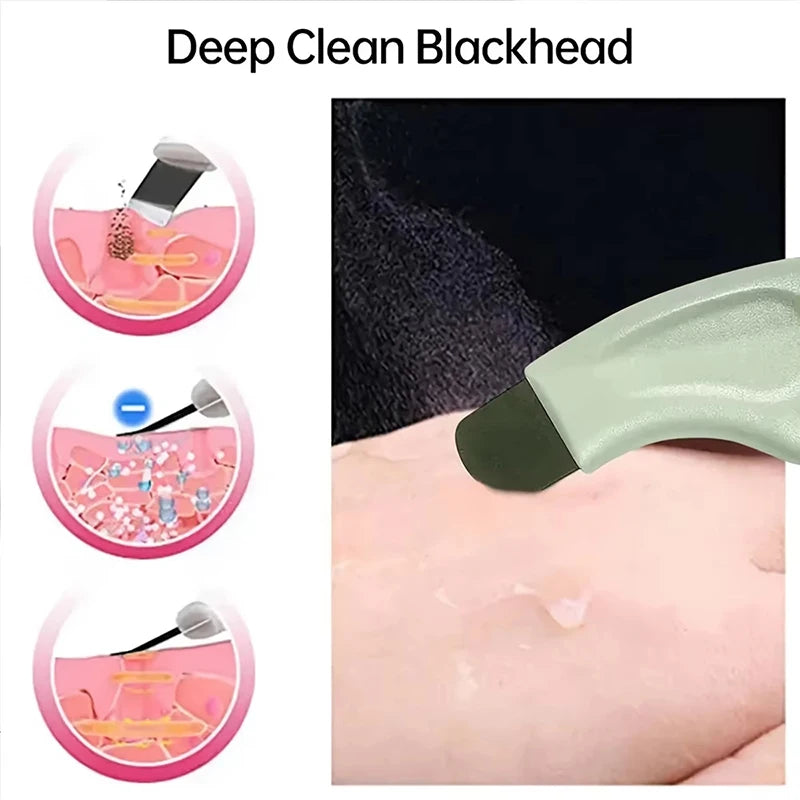 Deep Cleansing Blackhead & Whitehead Removal Tool for Nose and Face - Skin Pore Cleaner Skin Care Beauty Tools Hot Sale