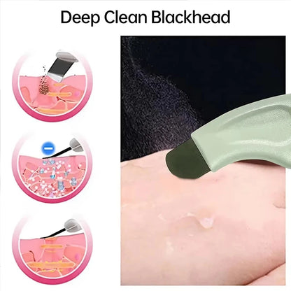 Deep Cleansing Blackhead & Whitehead Removal Tool for Nose and Face - Skin Pore Cleaner Skin Care Beauty Tools Hot Sale